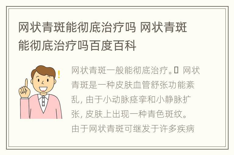 网状青斑能彻底治疗吗 网状青斑能彻底治疗吗百度百科