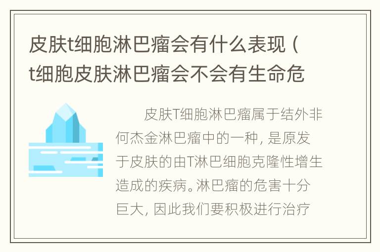 皮肤t细胞淋巴瘤会有什么表现（t细胞皮肤淋巴瘤会不会有生命危险）