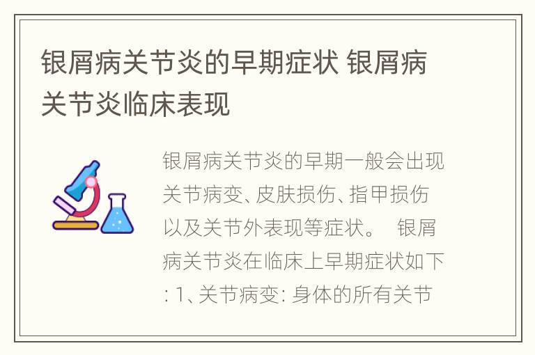 银屑病关节炎的早期症状 银屑病关节炎临床表现