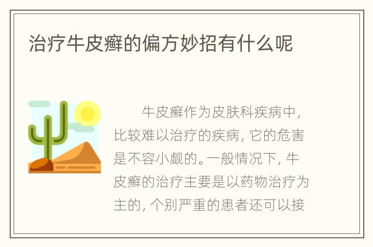 治疗牛皮癣的偏方妙招有什么呢