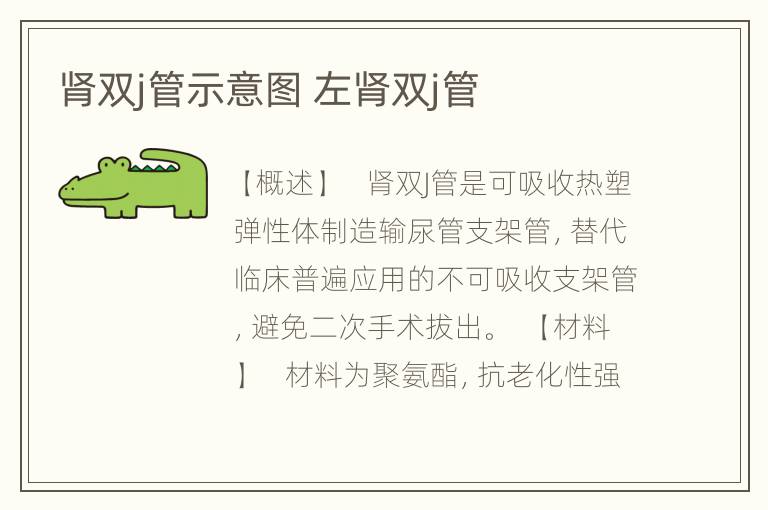 肾双j管示意图 左肾双j管