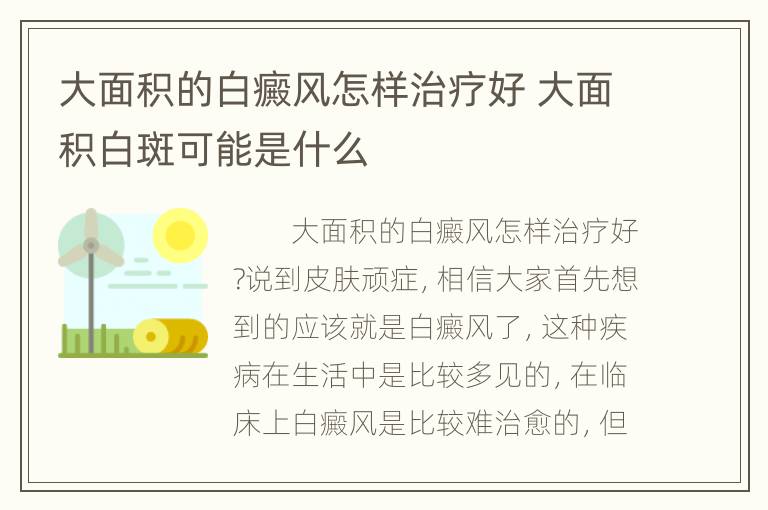 大面积的白癜风怎样治疗好 大面积白斑可能是什么