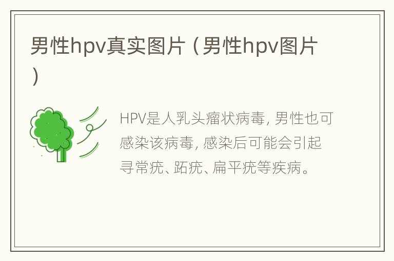 男性hpv真实图片（男性hpv图片）