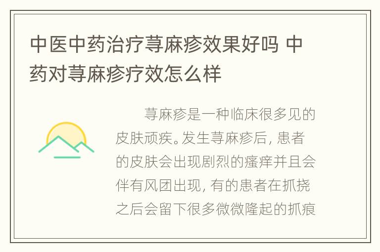 中医中药治疗荨麻疹效果好吗 中药对荨麻疹疗效怎么样