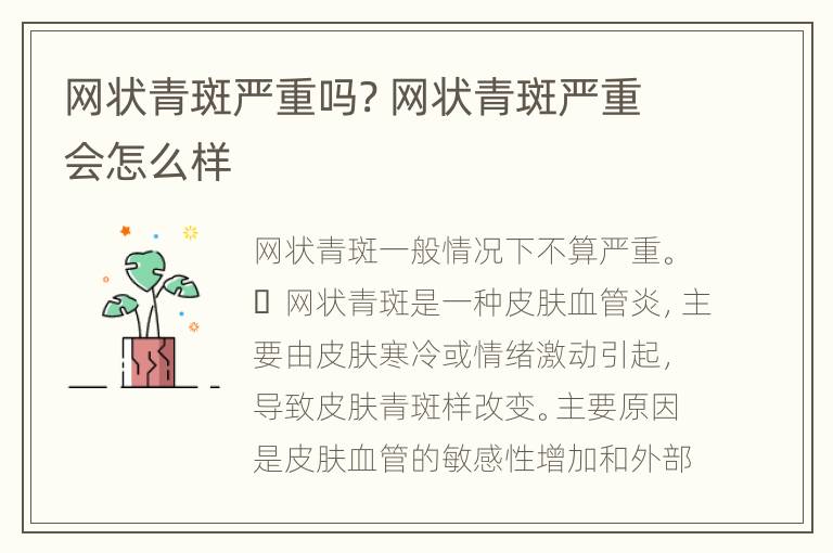 网状青斑严重吗? 网状青斑严重会怎么样