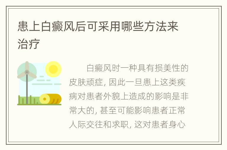 患上白癜风后可采用哪些方法来治疗